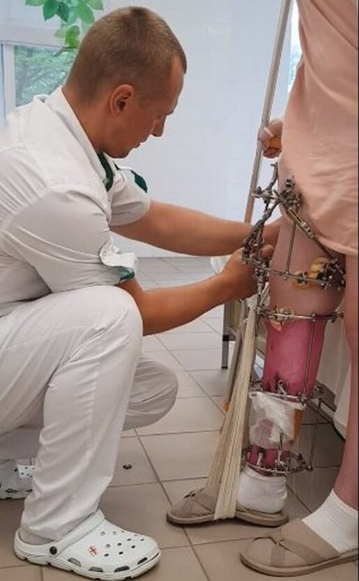В больнице Руднева врачи удлинили ногу на 13 см - новости Днепра
