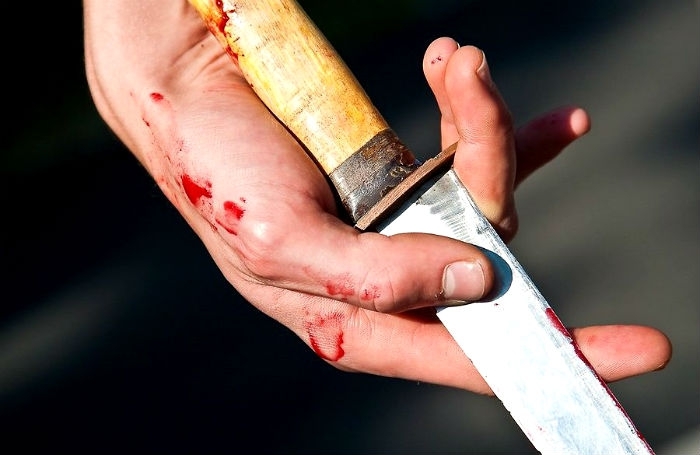 Новости Днепра про Из-за громкой музыки: на Поля 22-летний днепрянин получил ножевое ранение