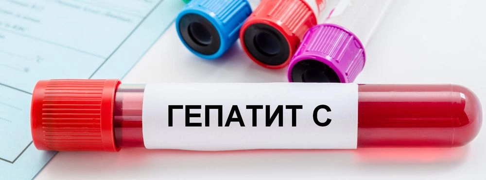 По регіонах України розподілять понад 16 тисяч курсів для безоплатного лікування вірусного гепатиту C